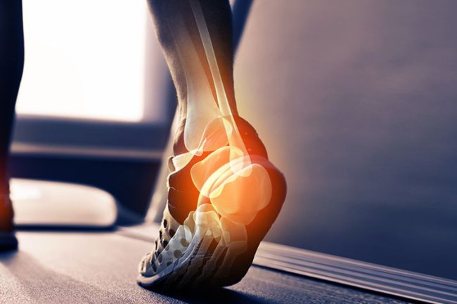 Discover the Daily Habits That Weaken Your Bones and What to Do