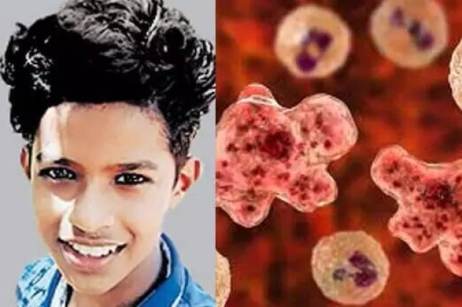 Brain-Eating Amoeba Claims Life of Boy in Kerala