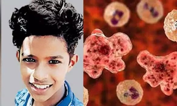 Brain-Eating Amoeba Claims Life of Boy in Kerala