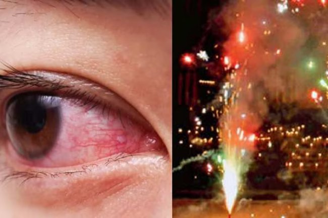 Diwali Eye Safety Guide