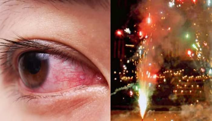 Diwali Eye Safety Guide