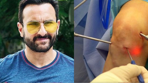 Saif Ali Khan Hospitalization: Actor Set for Knee Surgery